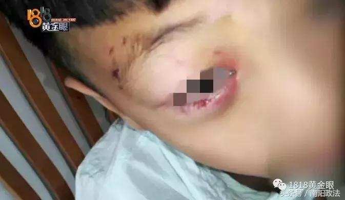 疫苗第四针，是否可以不打？疫苗第四针，是否必须接种？